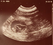 ultrasound Rosie border collie
